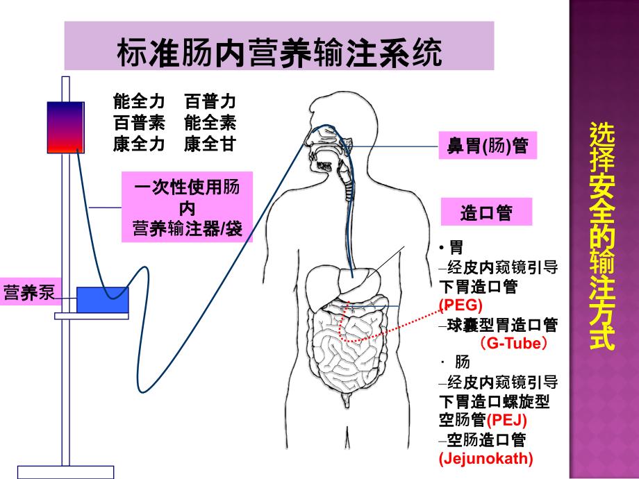 肠内营养并发症处理课件_第2页