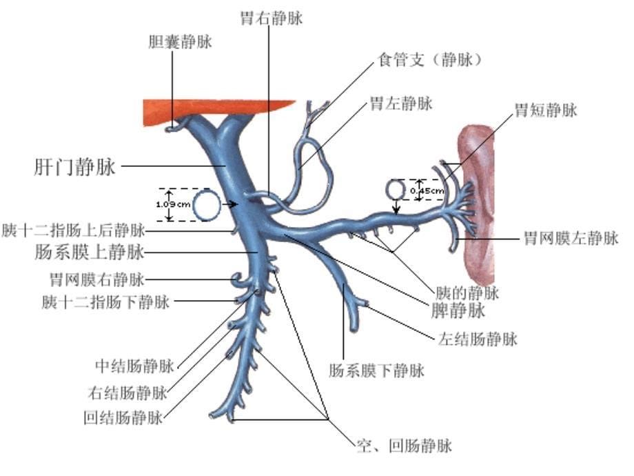 门静脉高压症少见成因及诊断_第5页