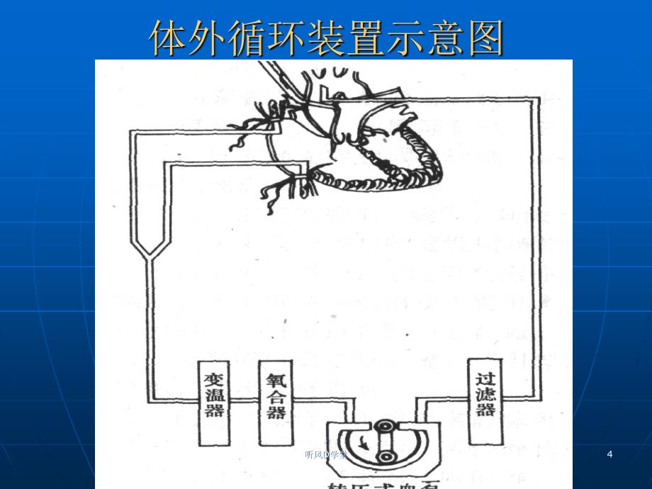 体外循环简介课堂运用_第4页