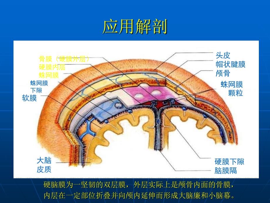 小脑幕硬膜下血肿_第4页