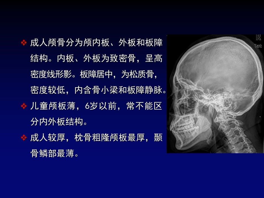 医学影像学：8中枢神经系统影像诊断_第5页