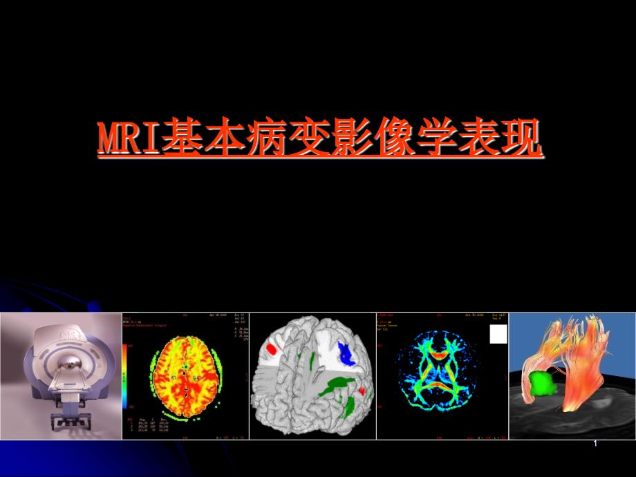 MRI基本病变影像学表现ppt参考课件_第1页