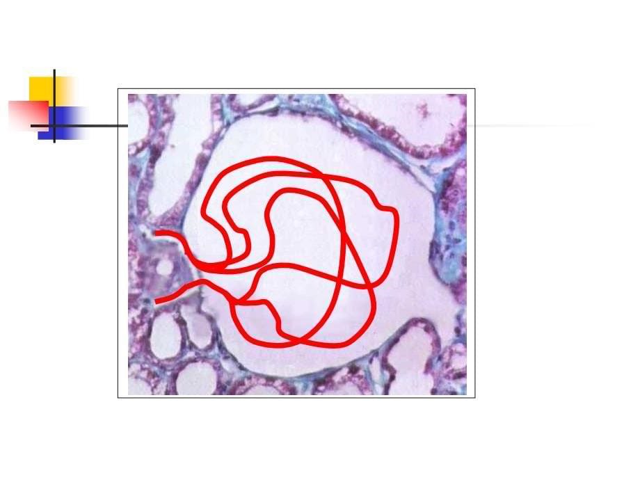 内科学泌尿系统肾小球疾病概述ppt课件.ppt_第5页