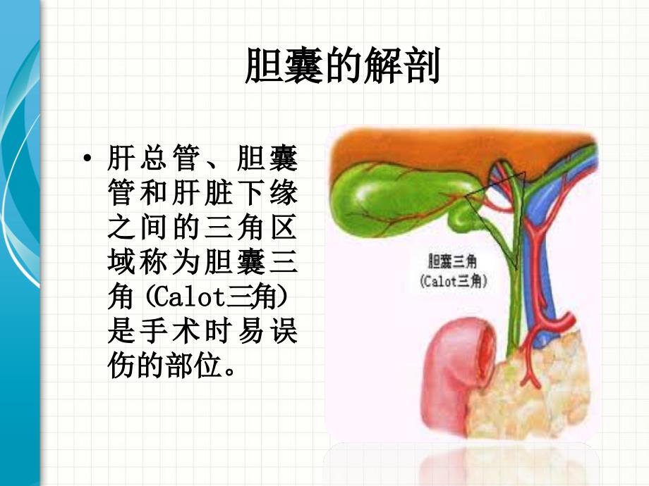 腹腔镜胆囊切除术护理查房.ppt_第4页