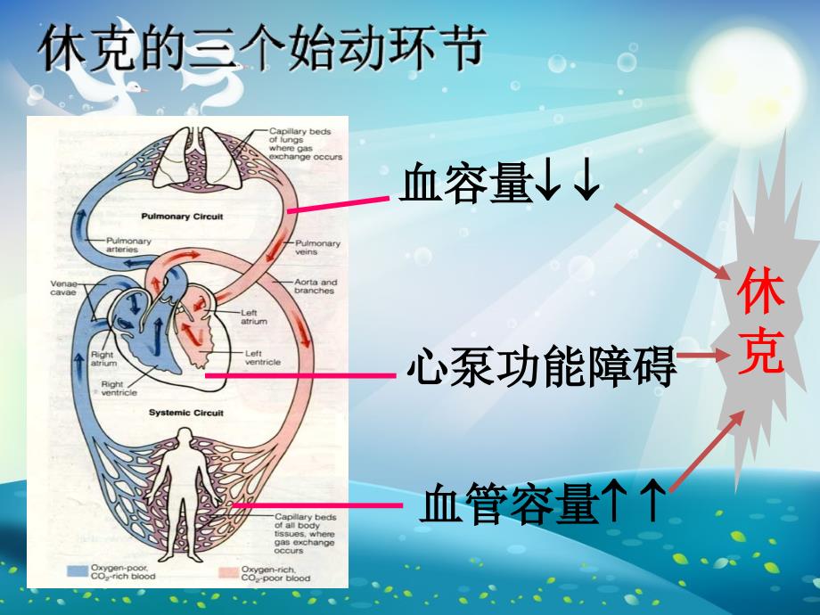 休克的分类及抢救ppt课件_第4页