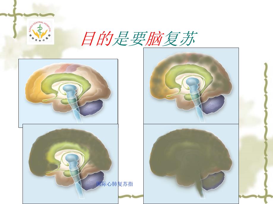 国际心肺复苏指课件_第4页