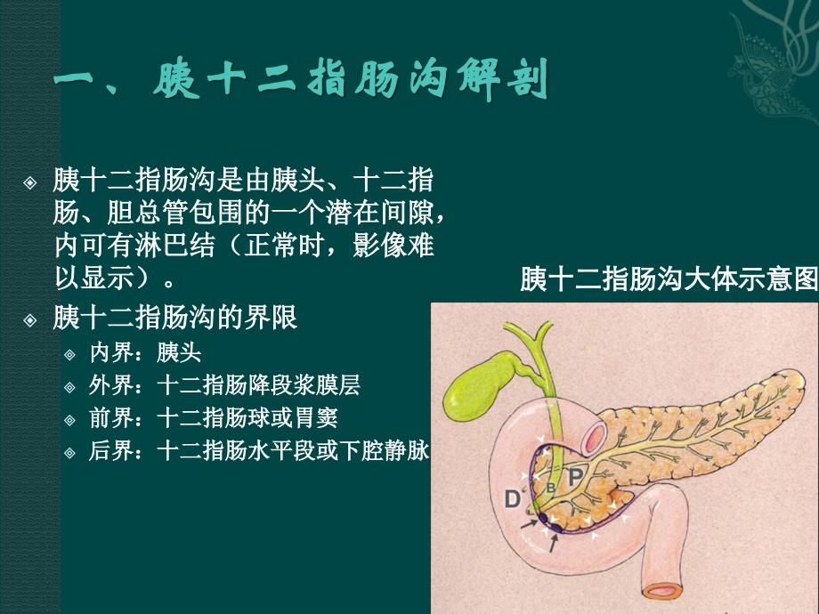 沟槽性胰腺炎.ppt_第2页