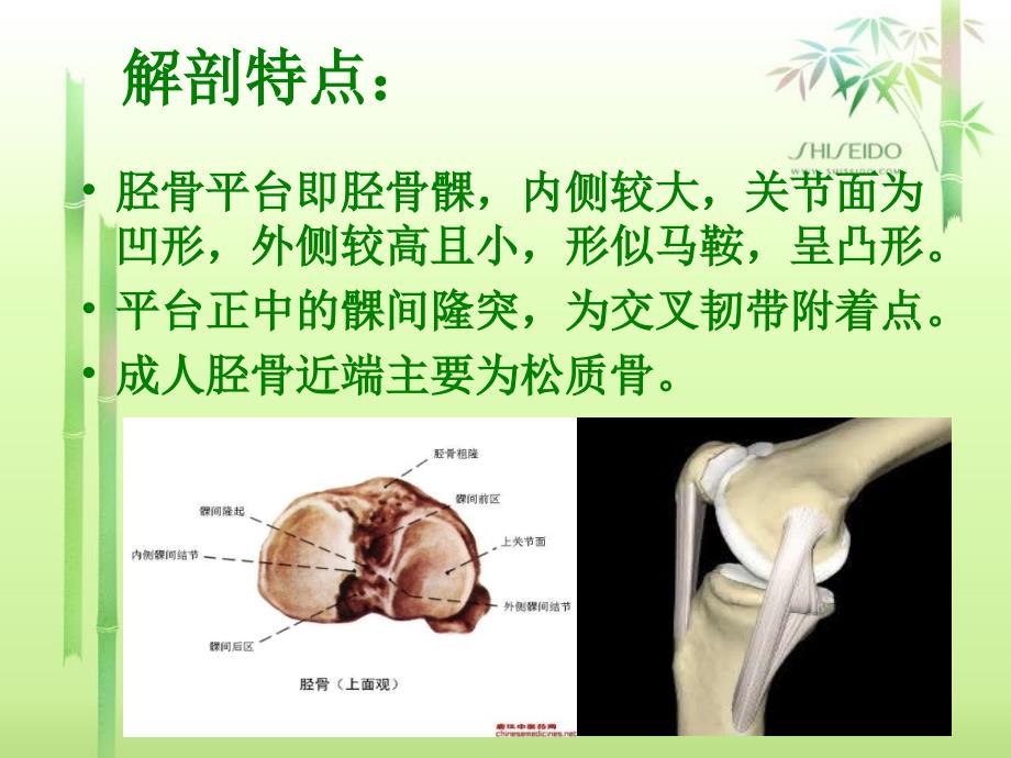 胫骨平台骨折PPT幻灯片_第3页