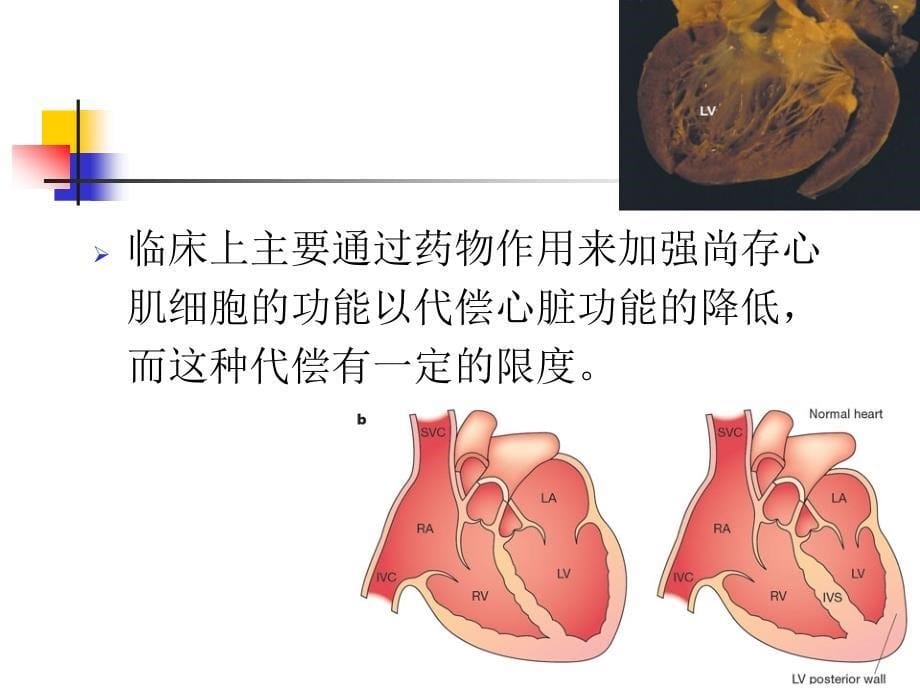 干细胞移植治疗漫性心脏功能损害的应用与进展_第5页