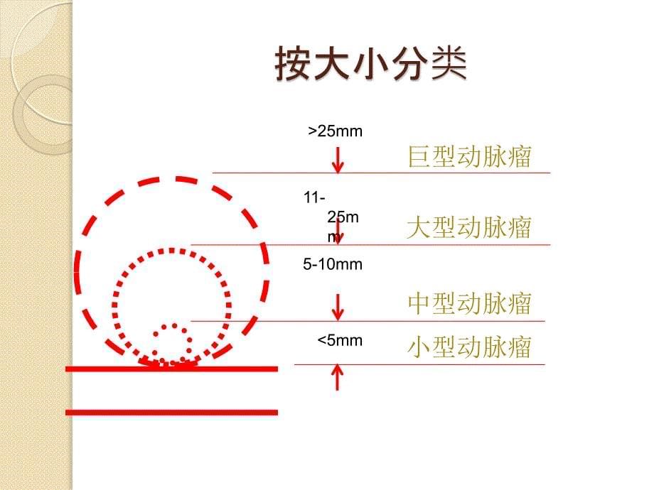 颅内动脉瘤围手术期护理.ppt_第5页