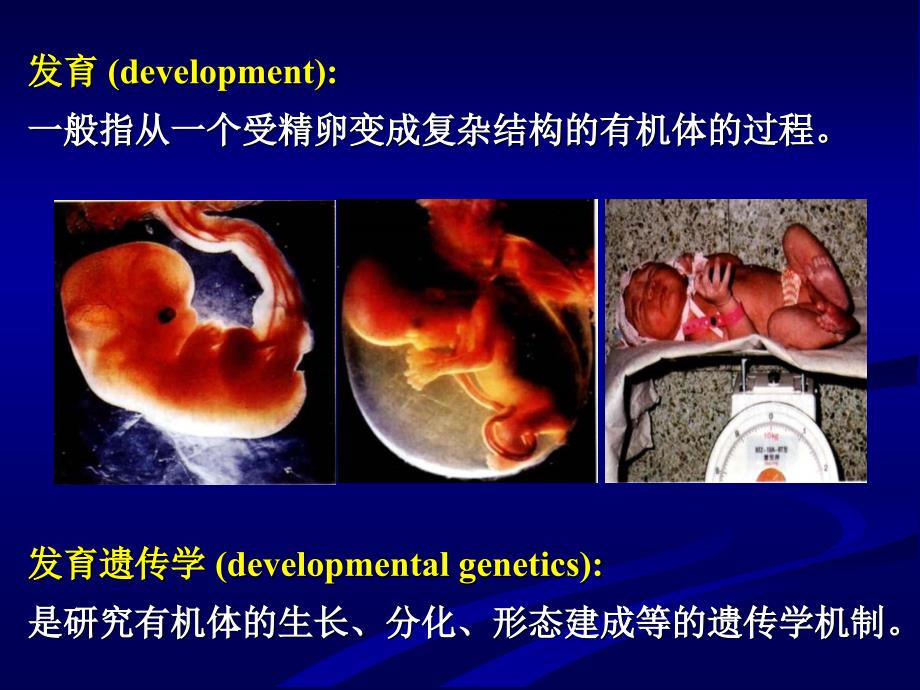 8-第十五章出生缺陷课件_第4页