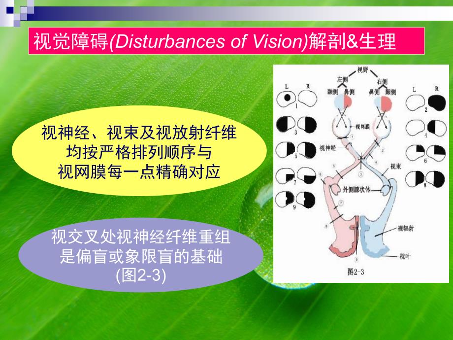 脑血管解剖图_第2页