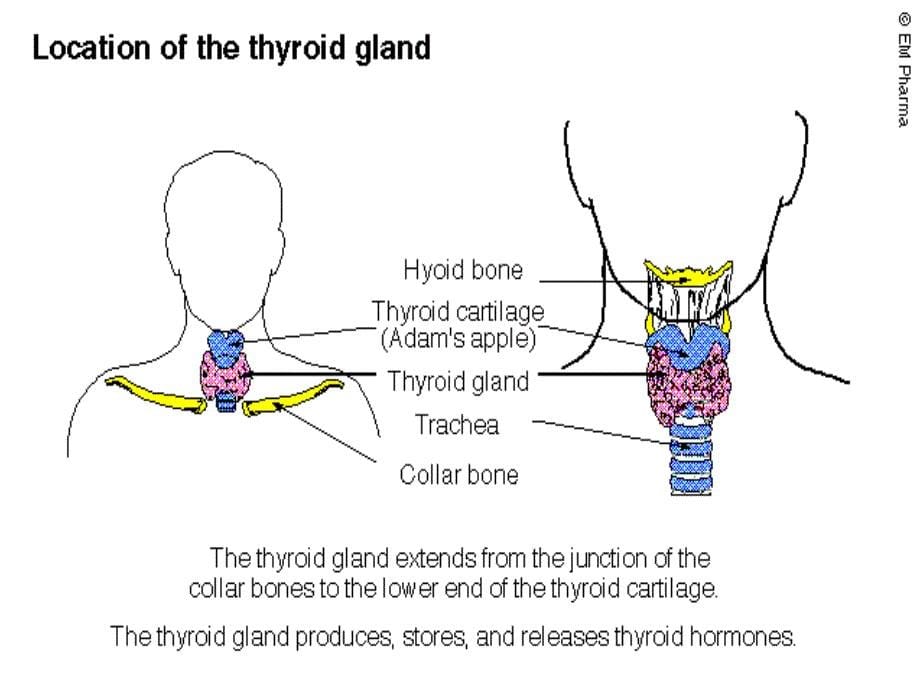 内科学教学课件：甲状腺机能亢进症Hyperthyroidism_第5页