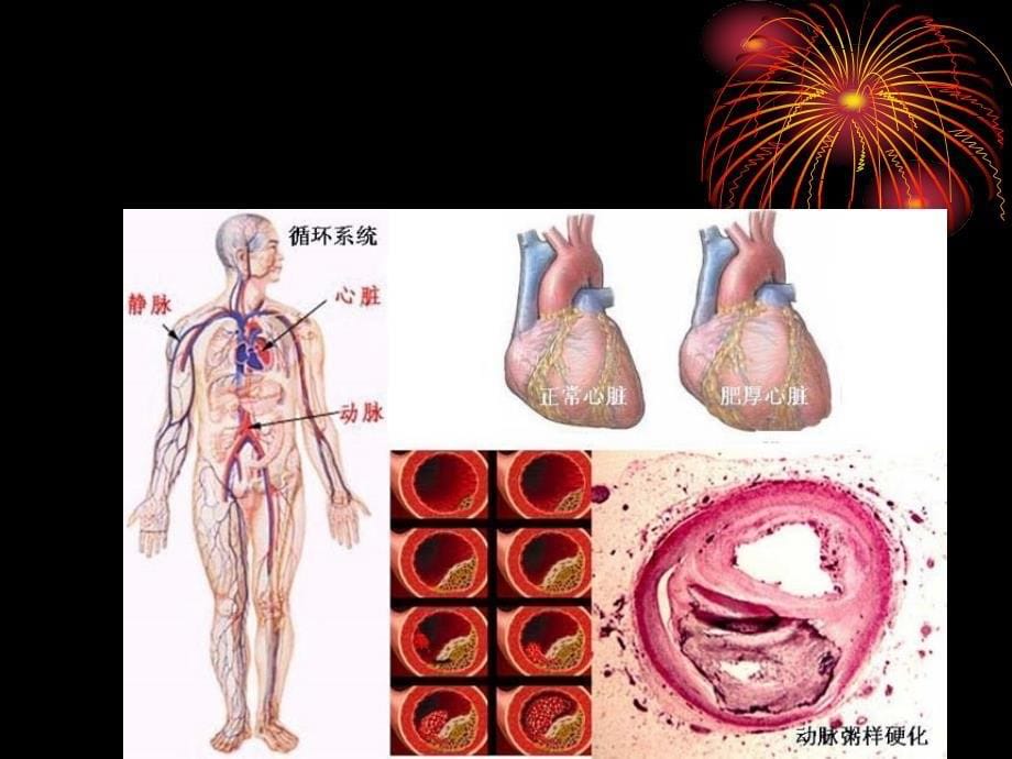 冠心病的营养治疗PPT课件_第5页