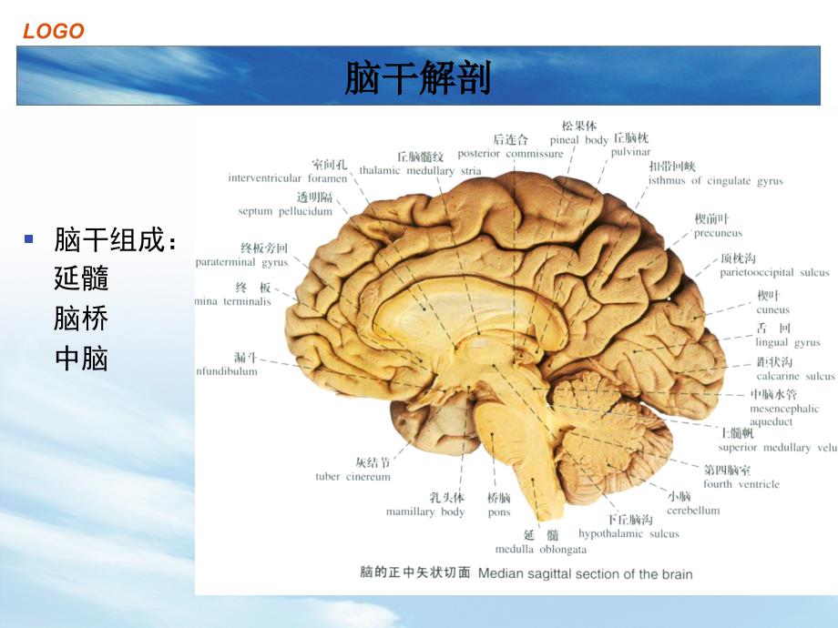 脑干出血.ppt_第3页