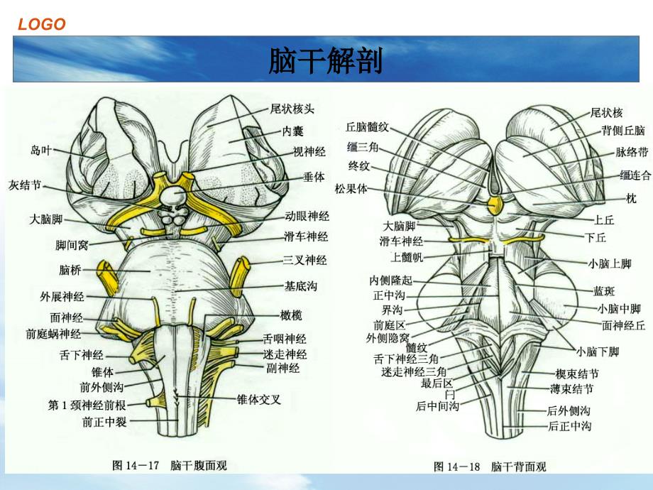 脑干出血.ppt_第4页