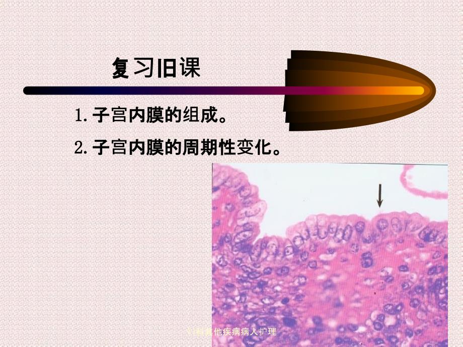 妇科其他疾病病人护理_第3页