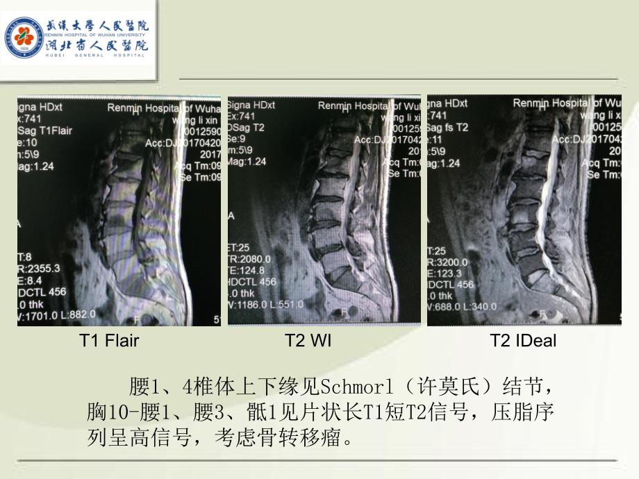 mri诊断入门病例二ppt课件_第2页