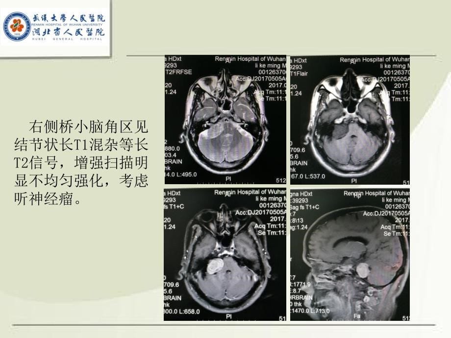 mri诊断入门病例二ppt课件_第5页