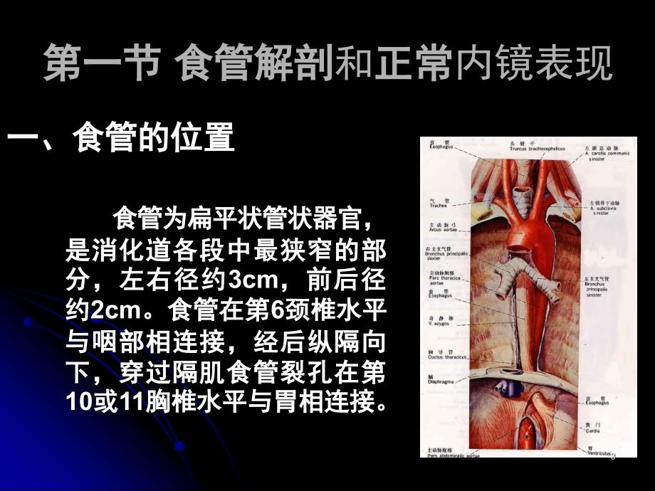 食管疾病.PPT_第3页