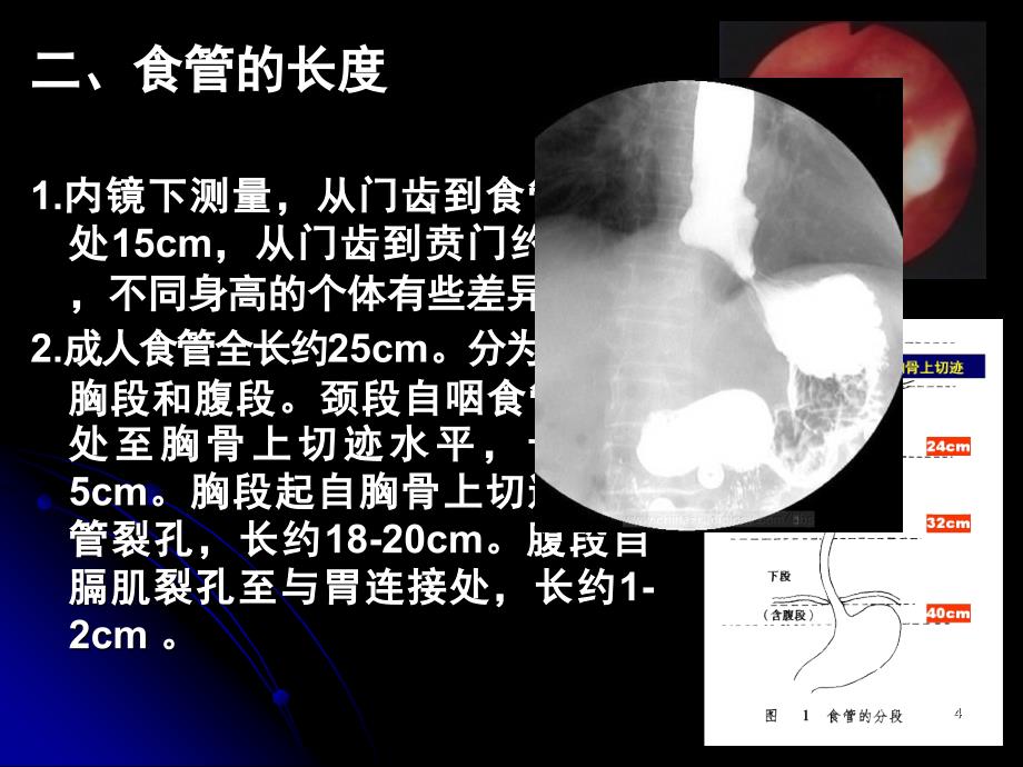 食管疾病.PPT_第4页