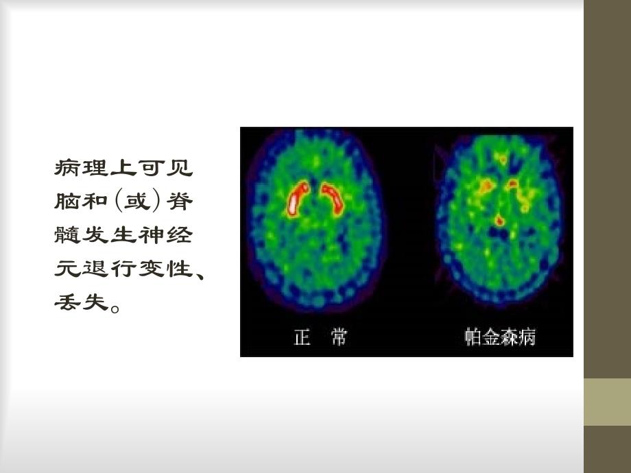 第六讲治疗中枢神经系统退行性疾病药_第3页