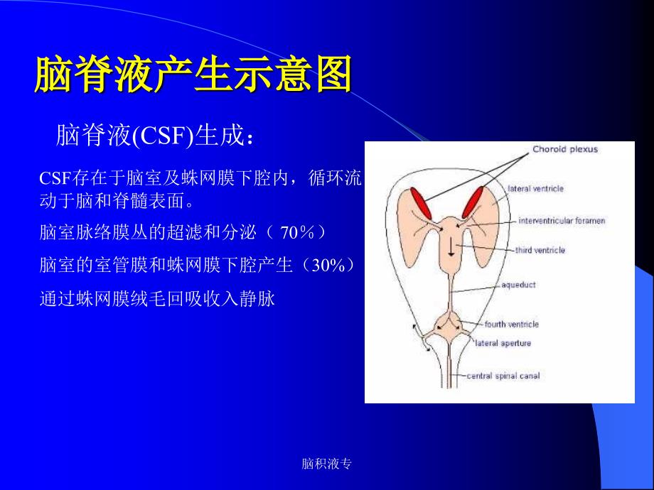 脑积液专课件_第2页