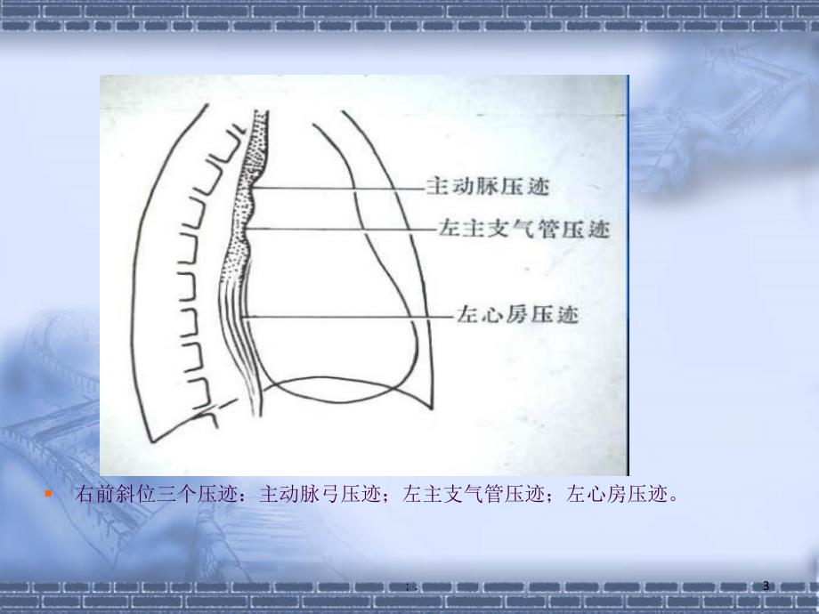 食管肿瘤的影像诊断ppt课件_第3页