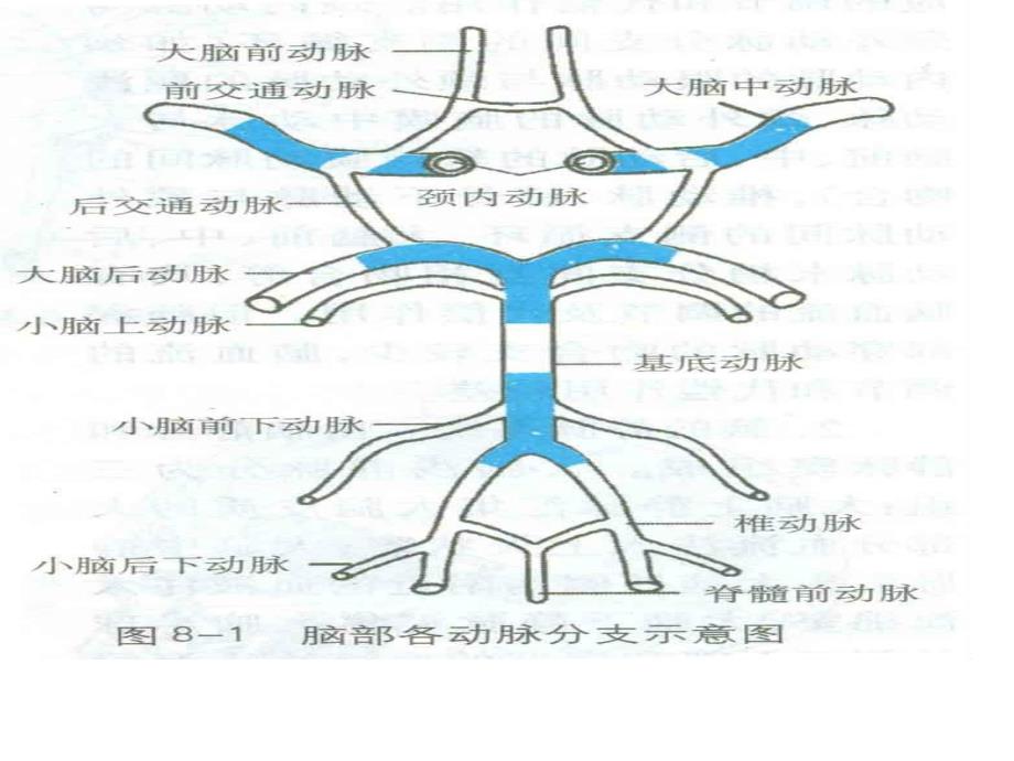 《脑梗死MRI表现》PPT课件_第4页