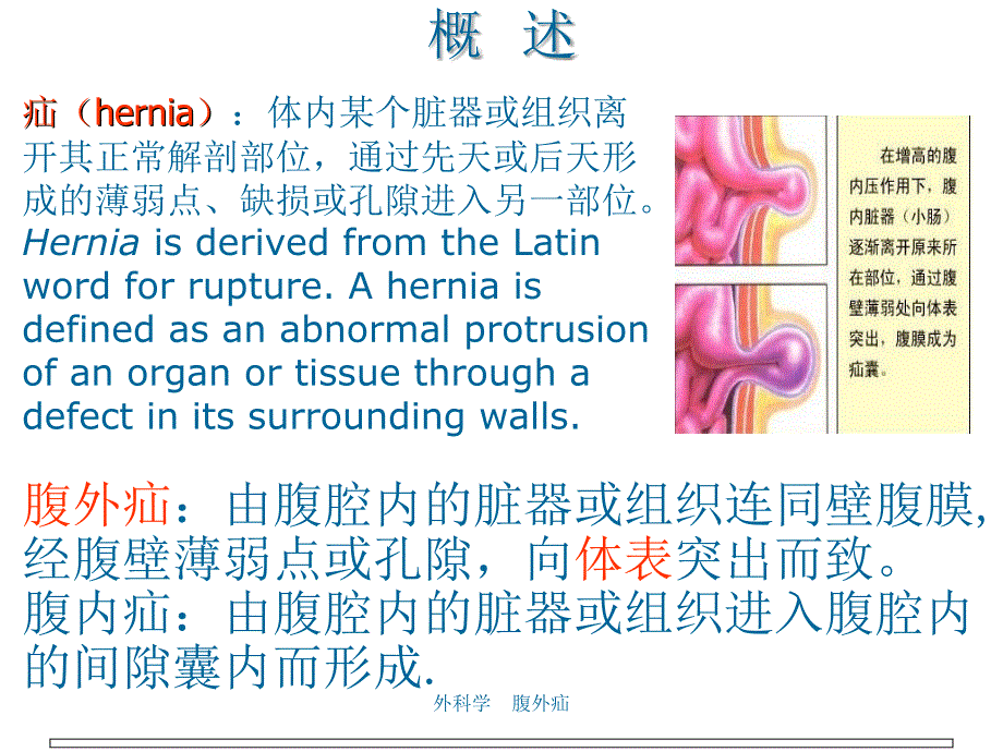 外科学腹外疝_第3页