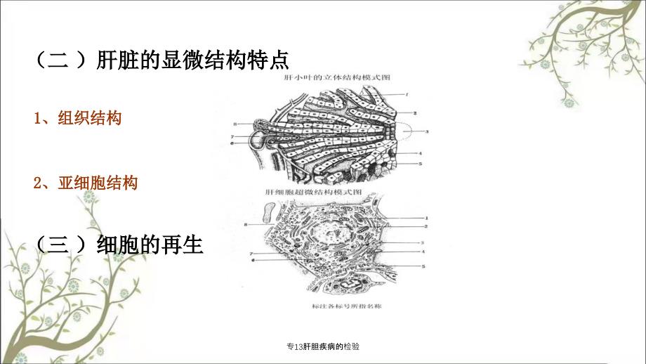 专13肝胆疾病的检验_第4页