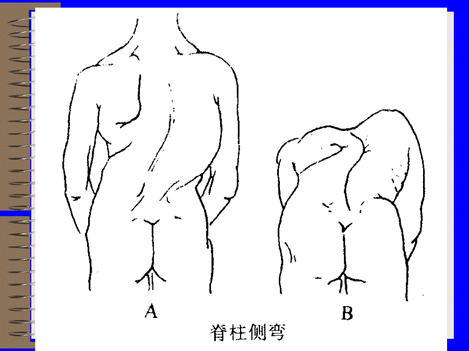 骨科神经系统检查ph_第3页