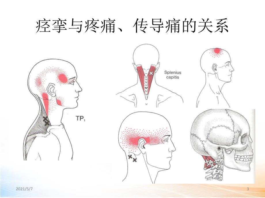 颈肩上肢痛的诊治2_第3页