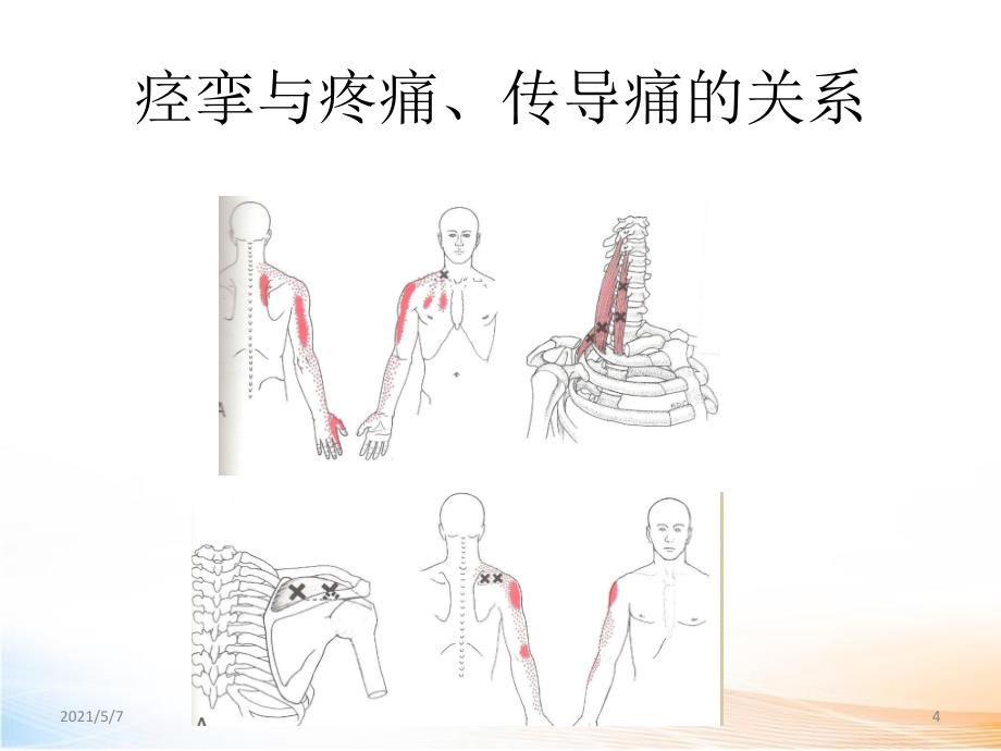 颈肩上肢痛的诊治2_第4页