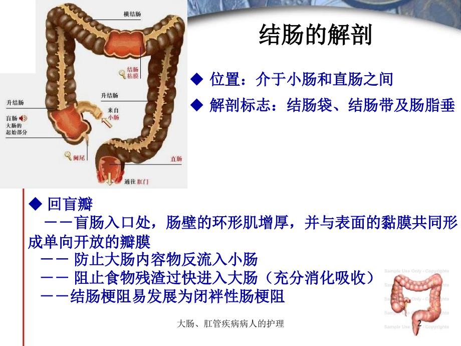 大肠肛管疾病病人的护理课件_第2页