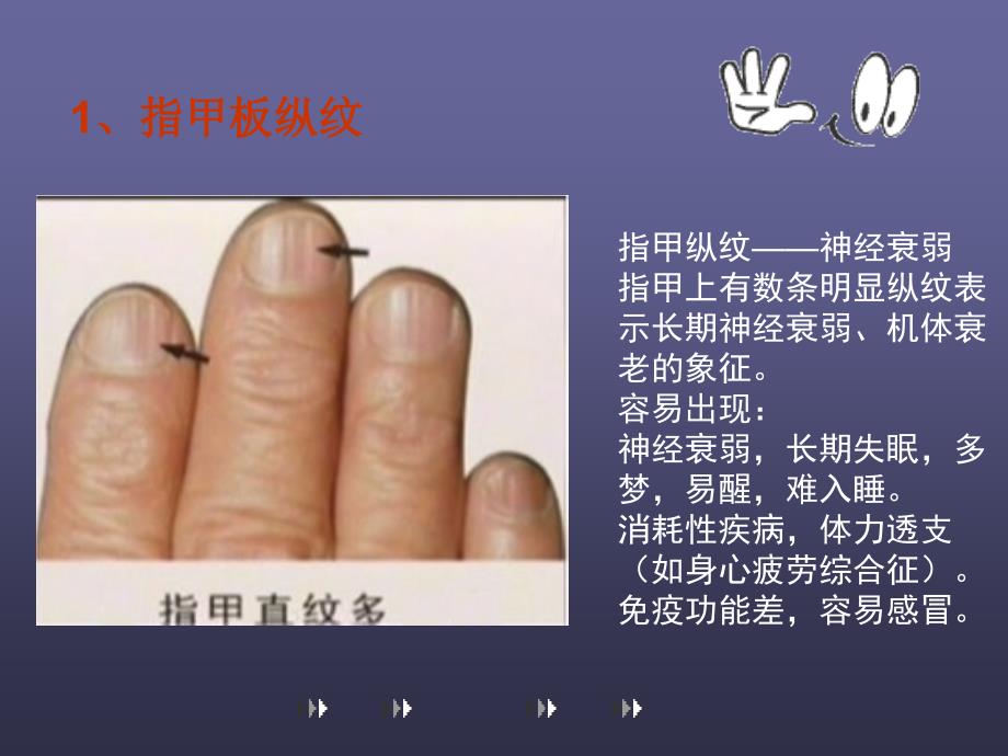 如何通过指甲检视健康_第2页