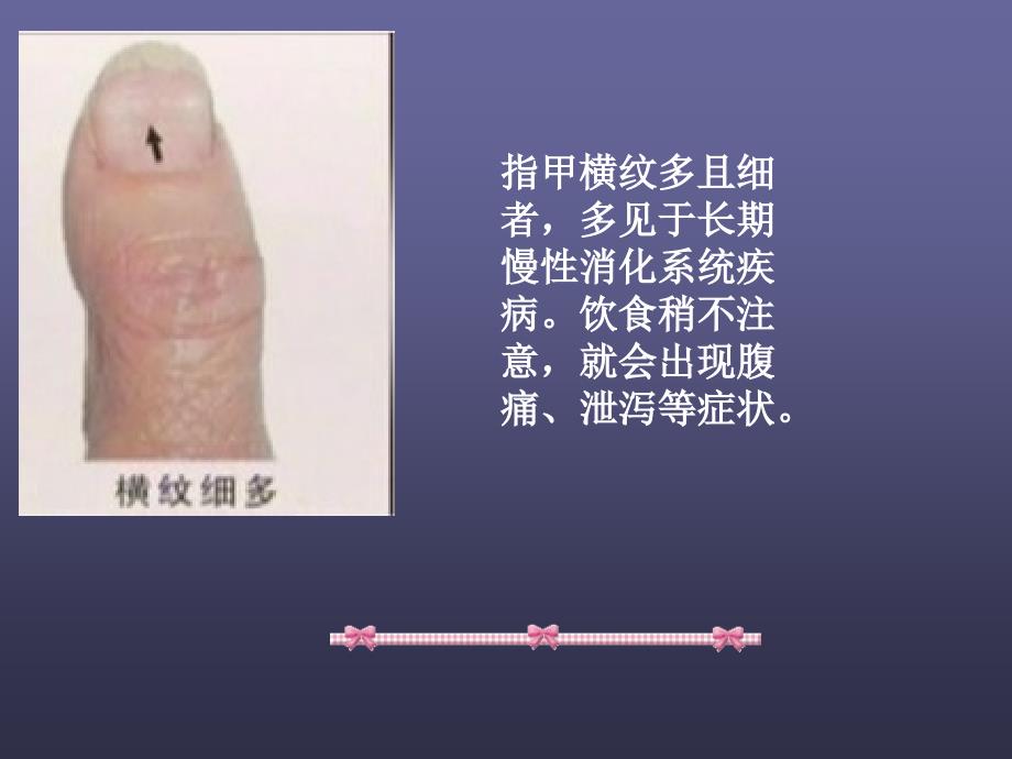 如何通过指甲检视健康_第4页