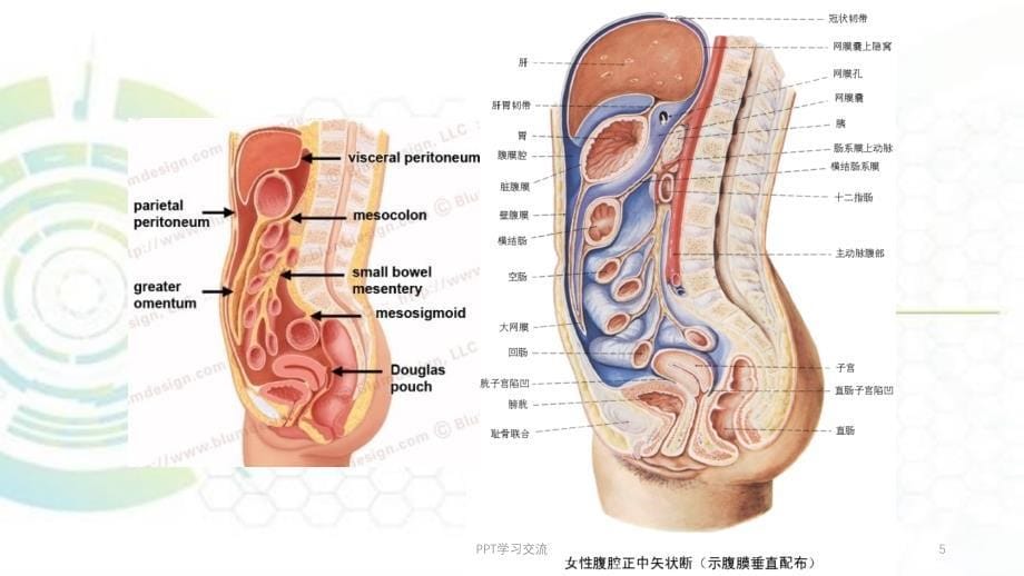 腹膜病变的CT表现ppt课件_第5页