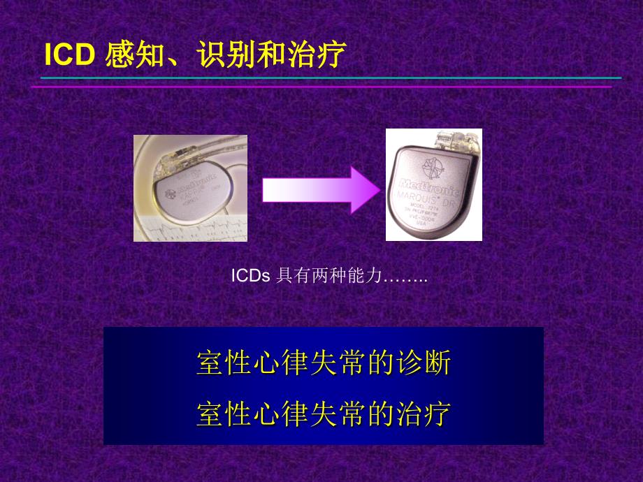 心脏起搏器培训资料：ICD 感知、识别和治疗_第1页