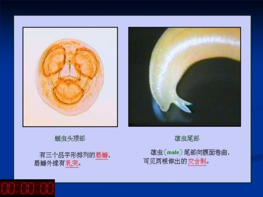 最新医学寄生虫学：蛔虫ppt课件_第5页