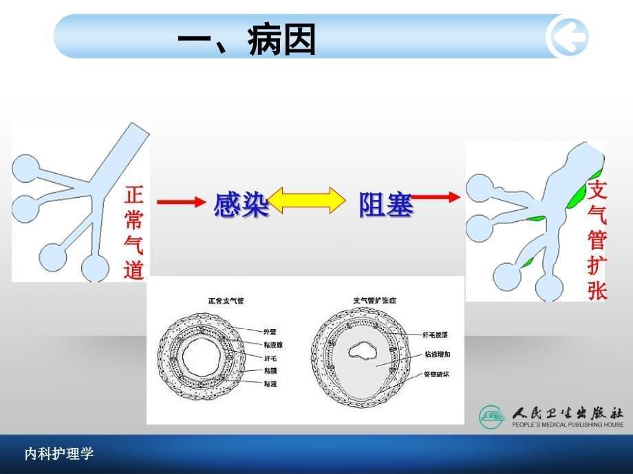 支气管扩张病人的护理1_第5页