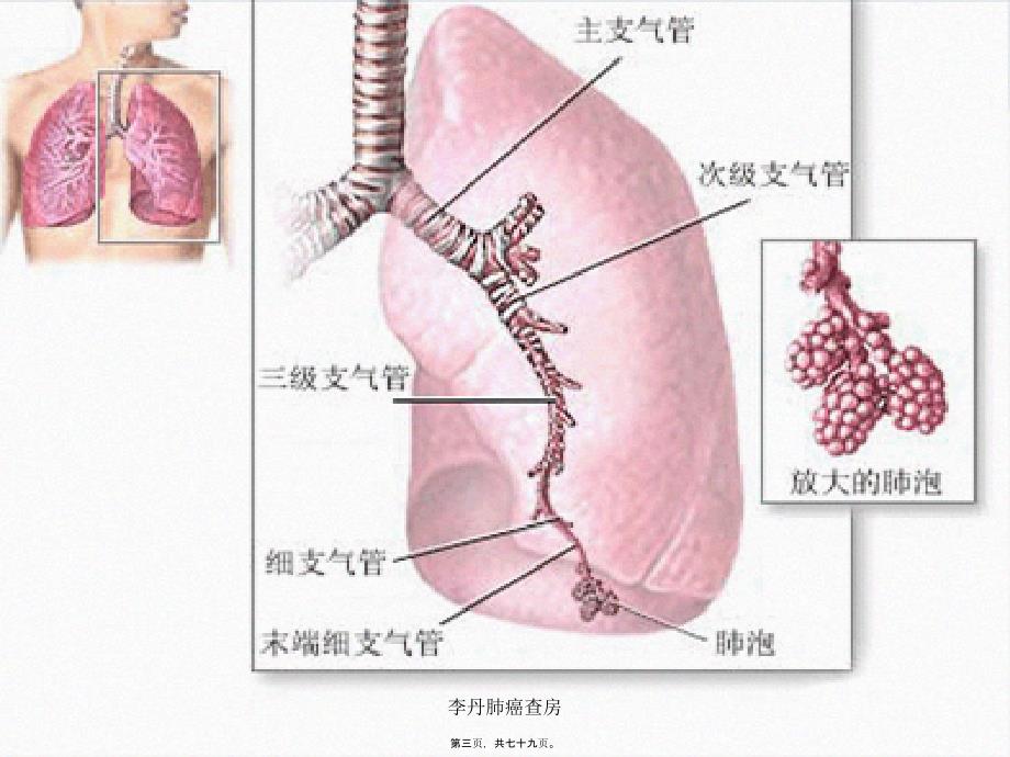 李丹肺癌查房课件_第3页