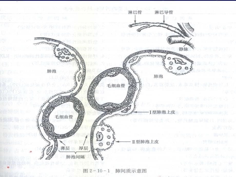 【医学ppt课件】间质性肺疾病_第5页