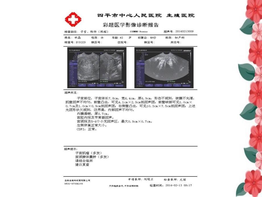 子宫动脉阻断治疗超声对比_第3页