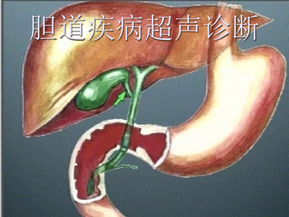 影像诊断学课件：胆道疾病超声诊断_第1页