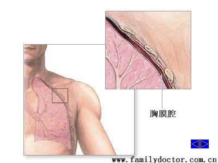 胸腔积液解析PPT课件_第5页