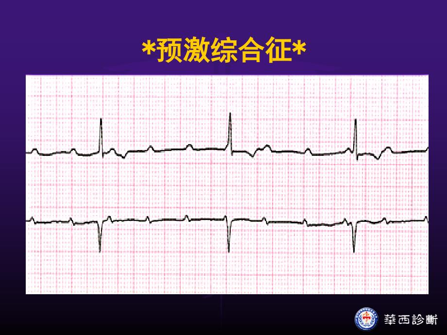 预激综合征和逸搏PPT课件_第4页