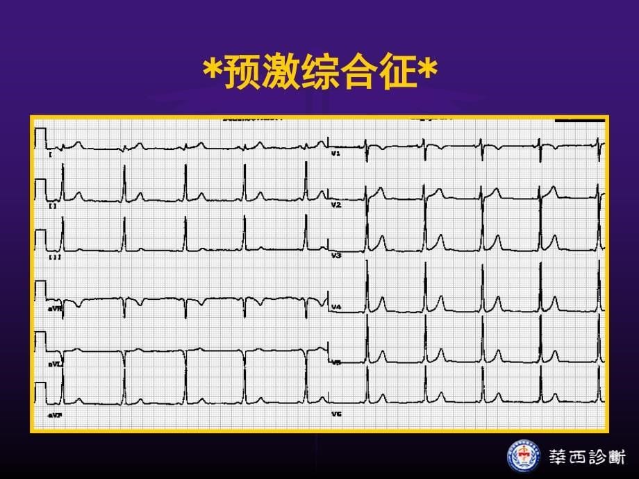 预激综合征和逸搏PPT课件_第5页