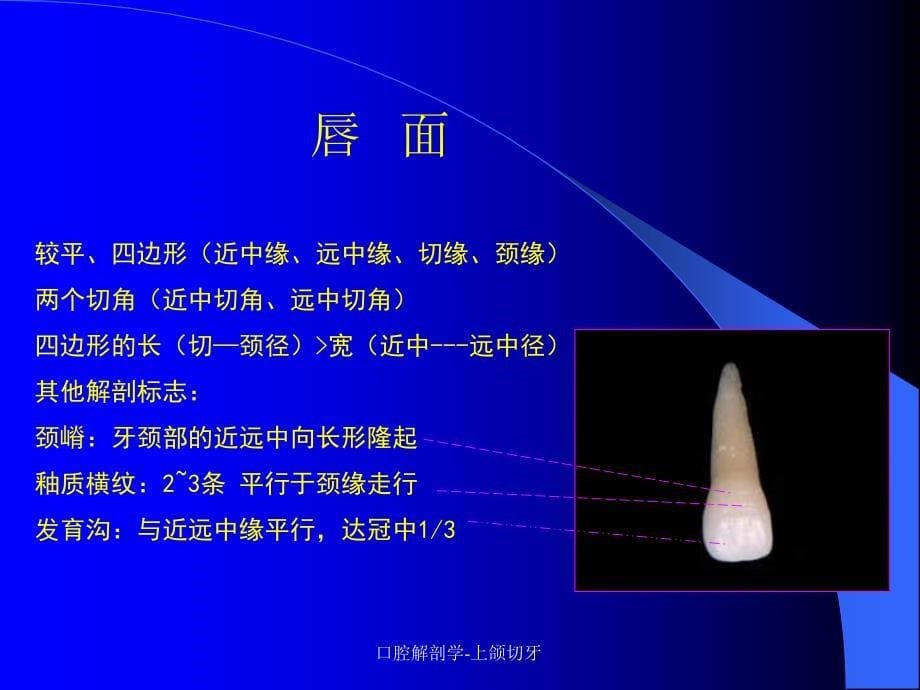 口腔解剖学上颌切牙_第5页