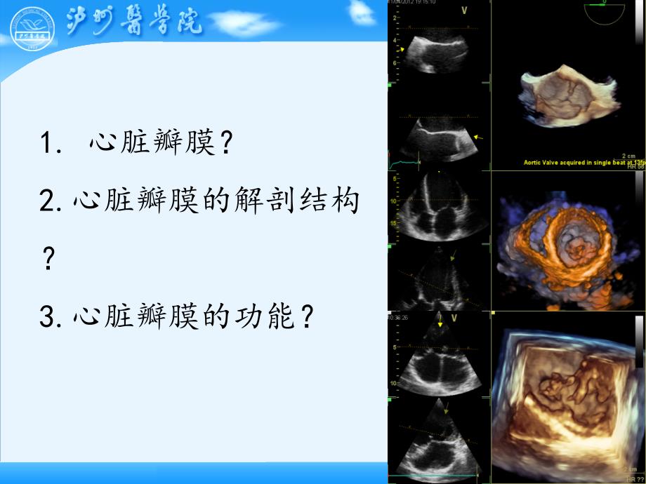 超声诊断学课件：心脏瓣膜病的超声诊断_第2页